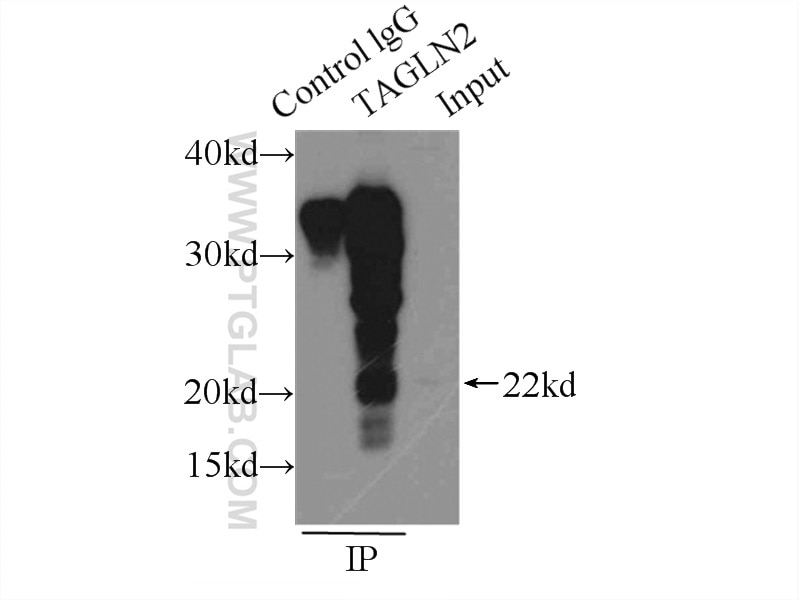 Immunoprecipitation (IP) experiment of L02 cells using Transgelin-2-specific Polyclonal antibody (15508-1-AP)