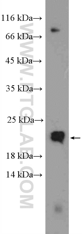 Western Blot (WB) analysis of HeLa cells using Transgelin-2-specific Polyclonal antibody (15508-1-AP)