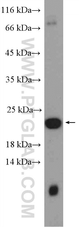 Western Blot (WB) analysis of HEK-293 cells using Transgelin-2-specific Polyclonal antibody (15508-1-AP)