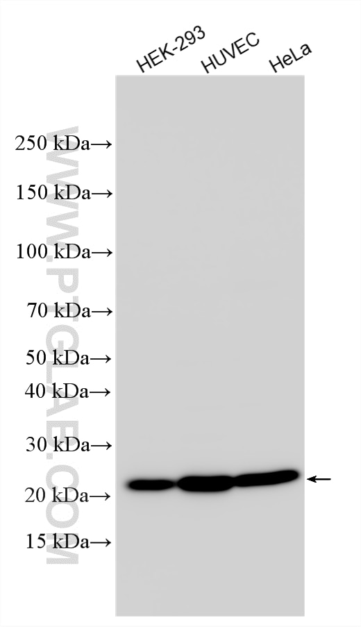 WB analysis using 15508-1-AP Western Blot (WB) analysis of various lysates using Transgelin-2-specific Polyclonal antibody (15508-1-AP)