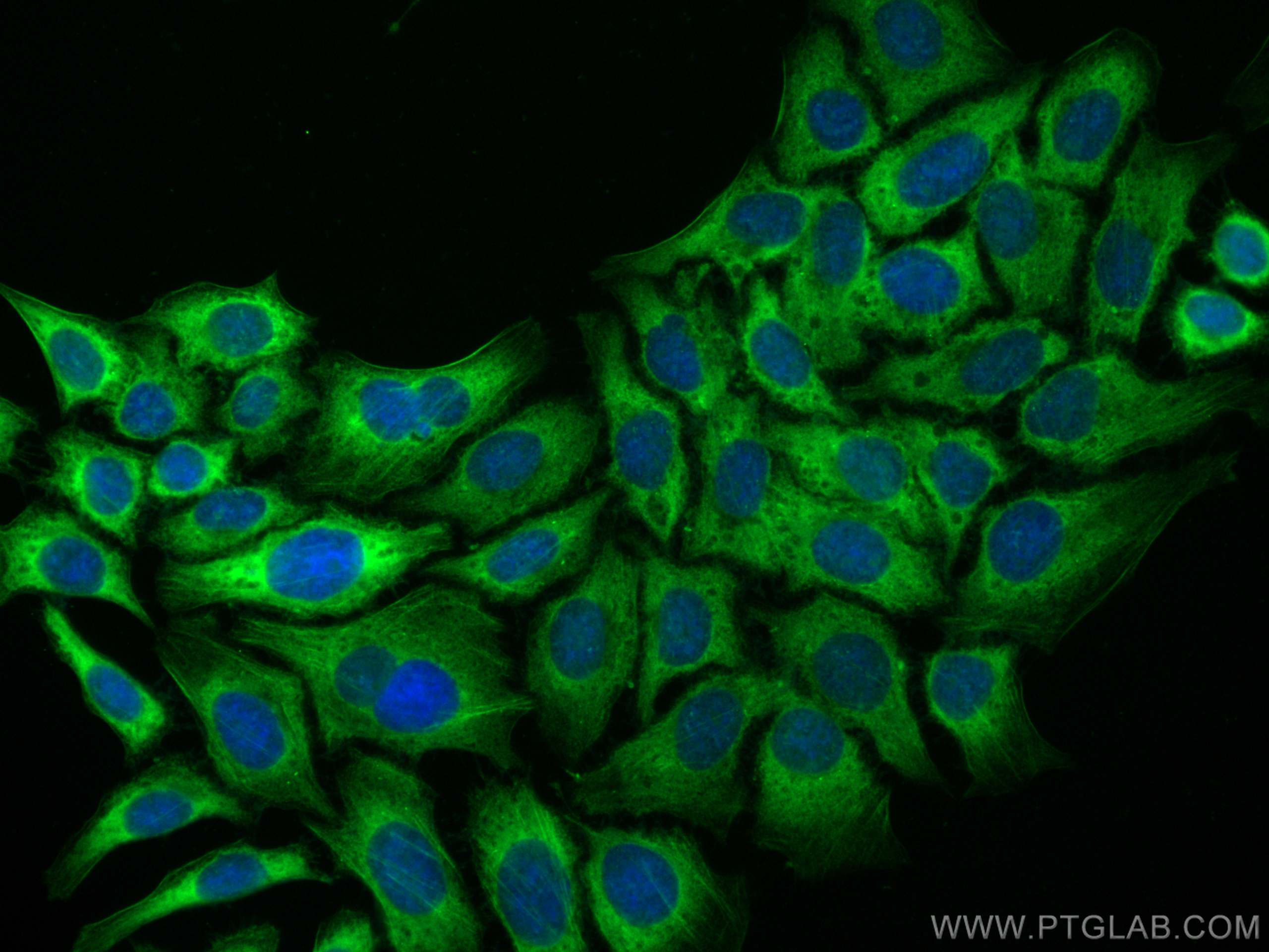 Immunofluorescence (IF) / fluorescent staining of HepG2 cells using CoraLite® Plus 488-conjugated Transgelin-2-specifi (CL488-15508)