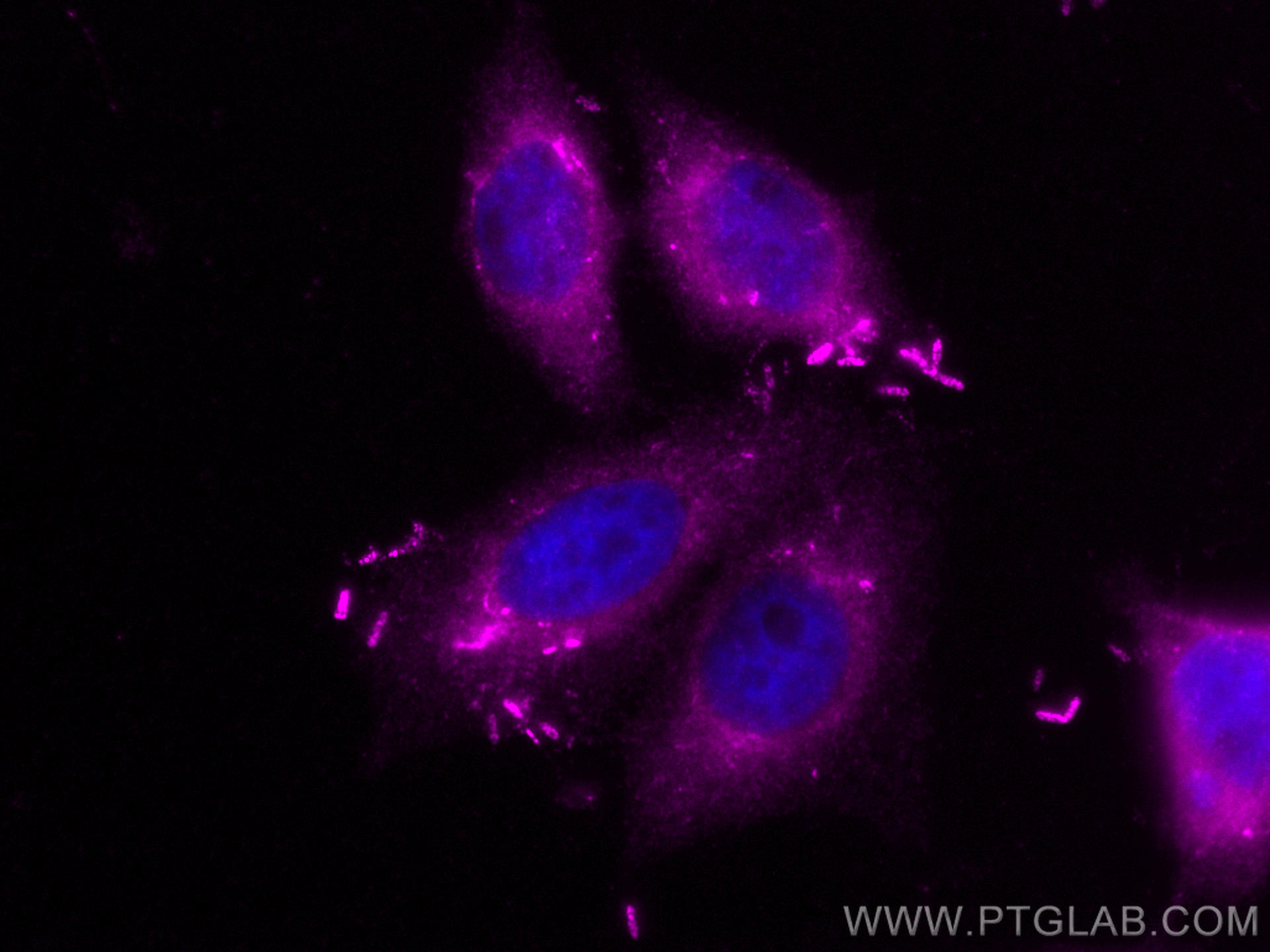 Immunofluorescence (IF) / fluorescent staining of HepG2 cells using CoraLite® Plus 647-conjugated Transgelin-2-specifi (CL647-15508)