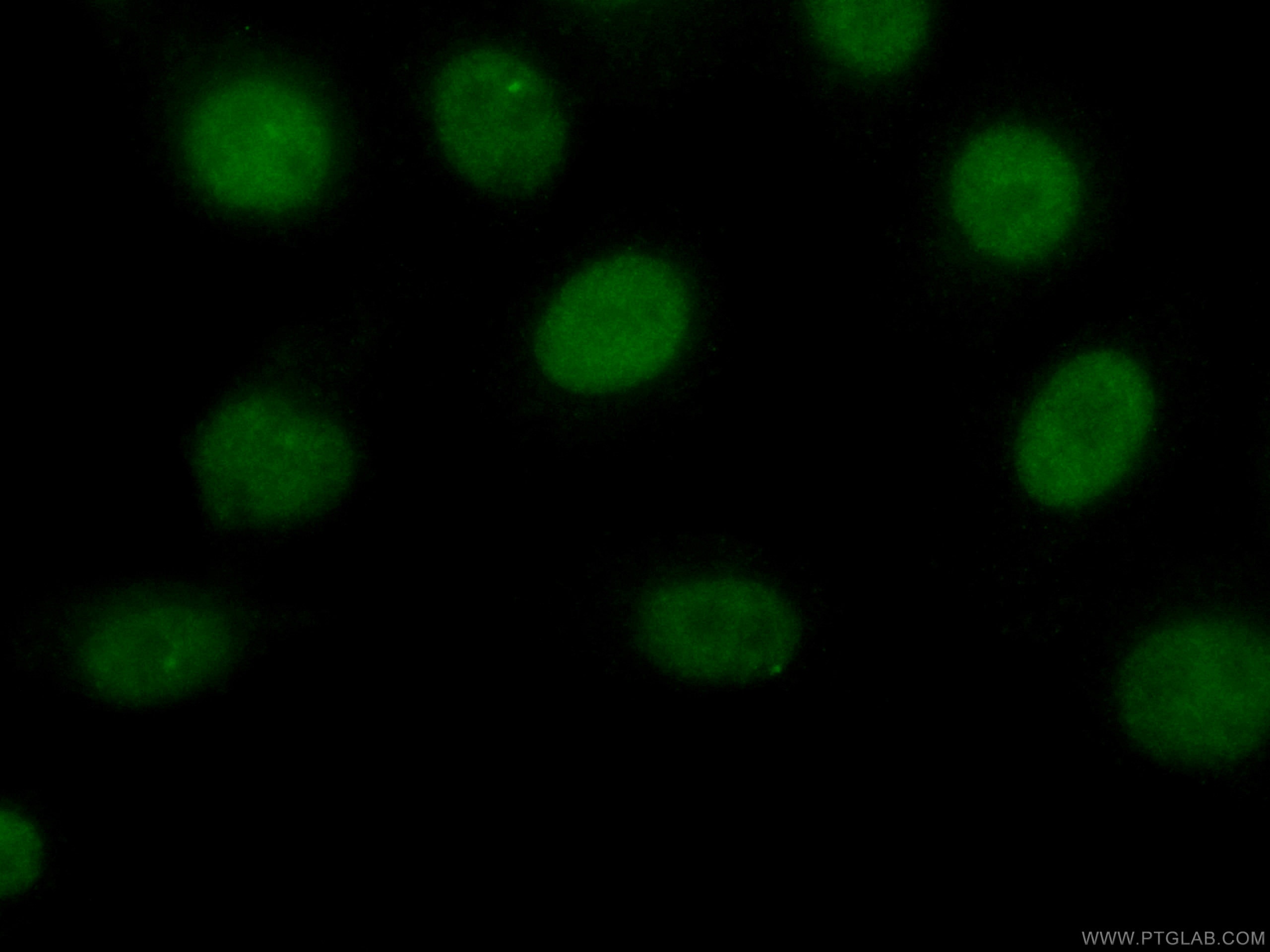 Immunofluorescence (IF) / fluorescent staining of HepG2 cells using CoraLite® Plus 488-conjugated Transketolase Monocl (CL488-66016)