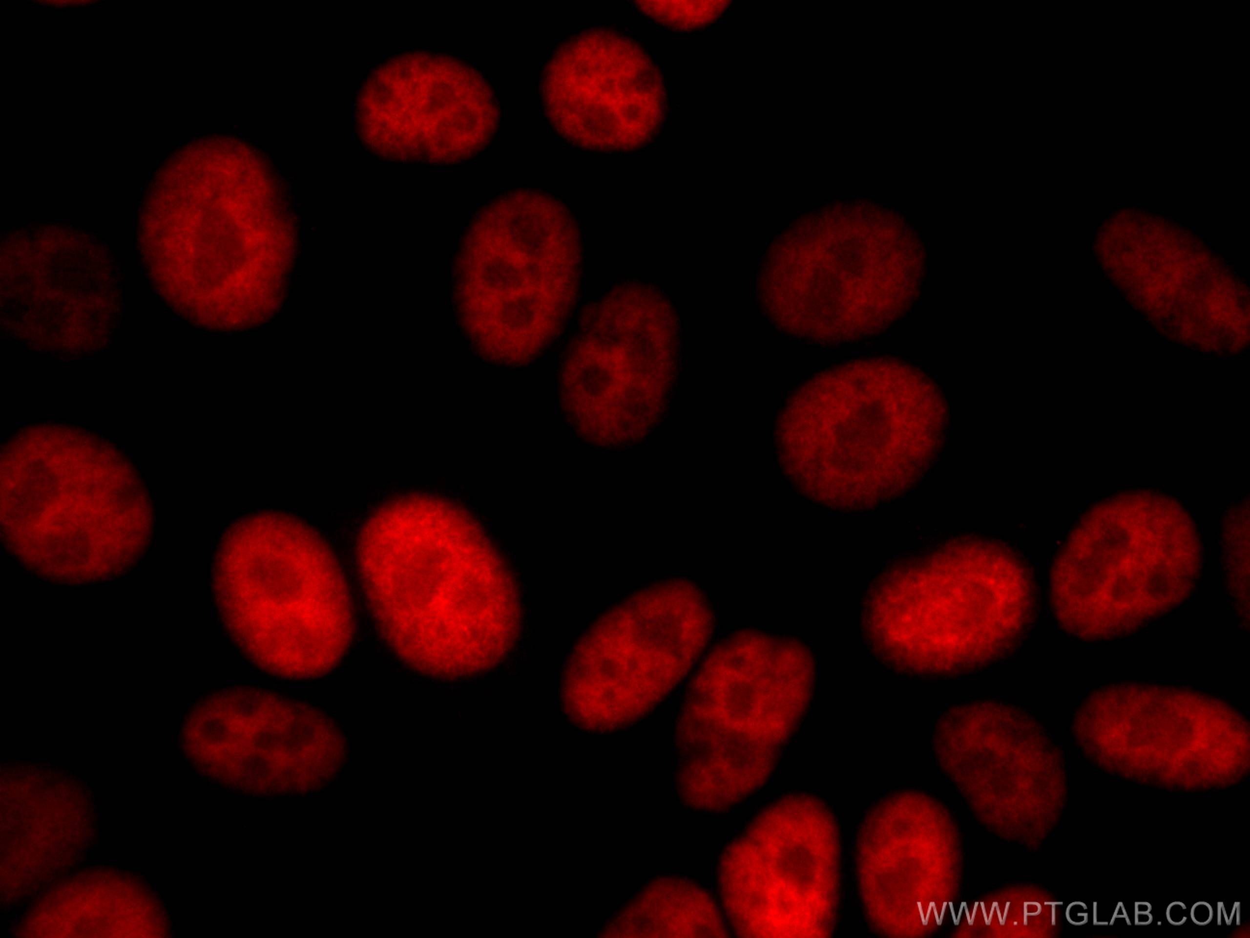 Immunofluorescence (IF) / fluorescent staining of HepG2 cells using CoraLite®594-conjugated Transketolase Monoclonal a (CL594-66016)
