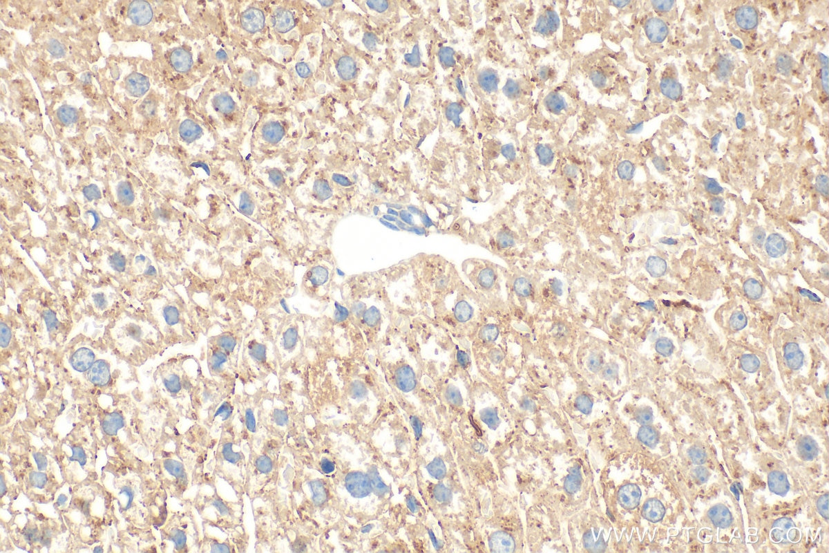 Immunohistochemistry (IHC) staining of mouse liver tissue using Transthyretin Polyclonal antibody (31130-1-AP)