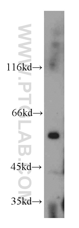 Western Blot (WB) analysis of mouse skeletal muscle tissue using Trappc9,NIBP Polyclonal antibody (20176-1-AP)