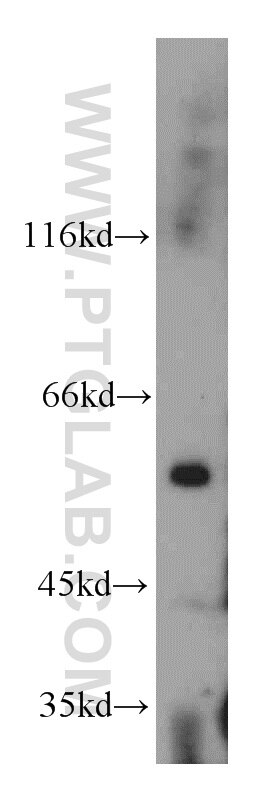 WB analysis of mouse skeletal muscle using 20176-1-AP