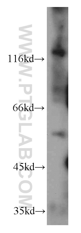 Western Blot (WB) analysis of mouse brain tissue using Trappc9,NIBP Polyclonal antibody (20176-1-AP)