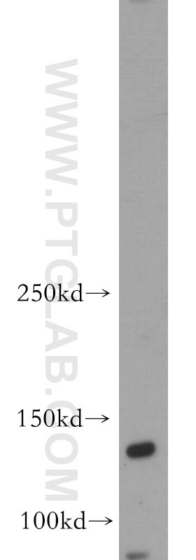 Western Blot (WB) analysis of SH-SY5Y cells using Trappc9,NIBP Polyclonal antibody (20176-1-AP)