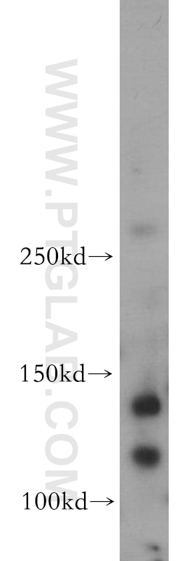 Western Blot (WB) analysis of Neuro-2a cells using Trappc9,NIBP Polyclonal antibody (20176-1-AP)