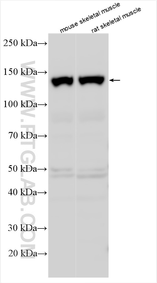 Western Blot (WB) analysis of various lysates using Trappc9,NIBP Polyclonal antibody (20287-1-AP)