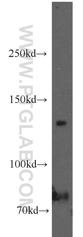 Trappc9,NIBP