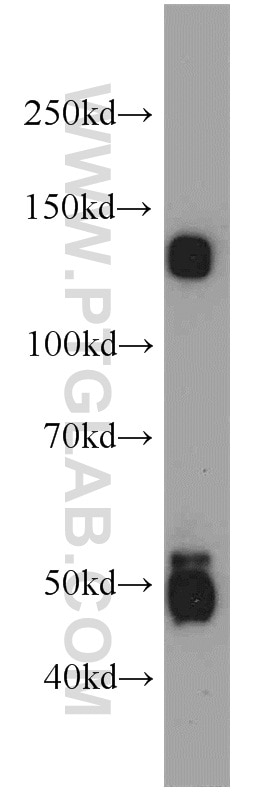 Western Blot (WB) analysis of MCF-7 cells using Trappc9,NIBP Polyclonal antibody (20287-1-AP)