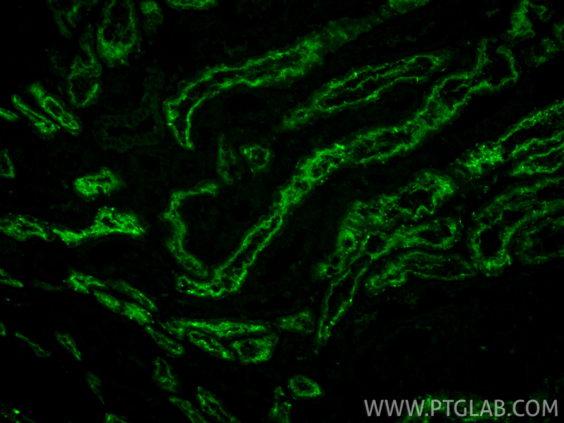 Immunofluorescent analysis of (4% PFA) fixed paraffin-embedded human kidney tissue using Trehalase antibody (21685-1-AP) at dilution of 1:200 and CoraLite®488-Conjugated Goat Anti-Rabbit IgG(H+L) (SA00013-2). Heat mediated antigen retrieval with Tris-EDTA buffer (pH 9.0). Immunofluorescence (IF) / fluorescent staining of human kidney tissue using Trehalase Polyclonal antibody (21685-1-AP)