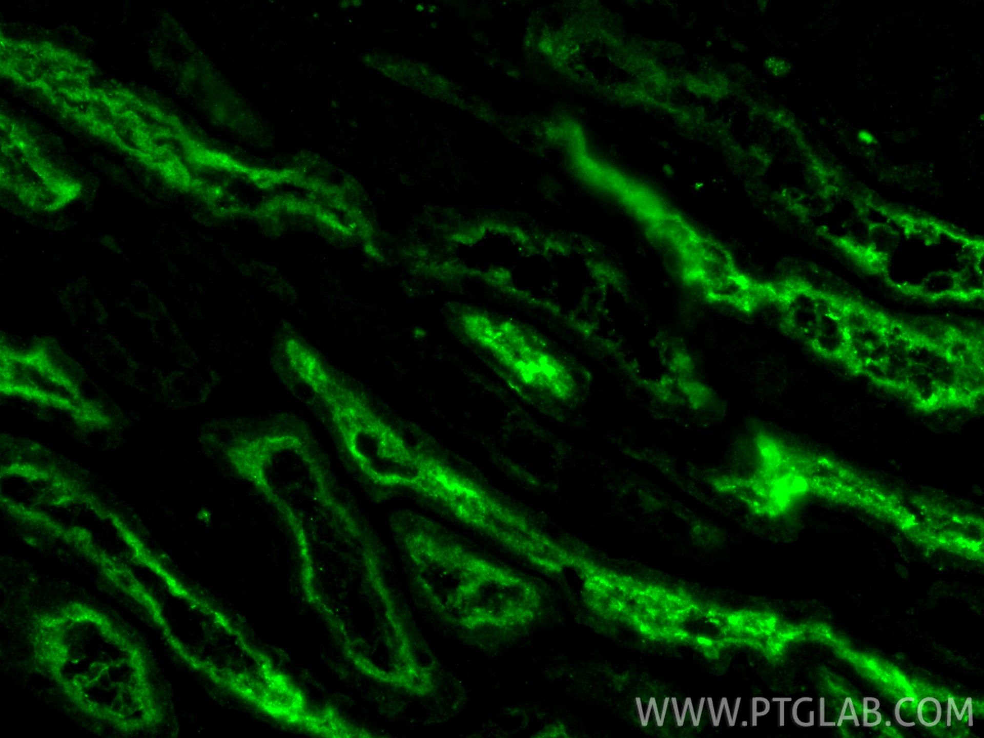 Immunofluorescent analysis of (4% PFA) fixed paraffin-embedded human kidney tissue using Trehalase antibody (21685-1-AP) at dilution of 1:200 and CoraLite®488-Conjugated Goat Anti-Rabbit IgG(H+L) (SA00013-2). Heat mediated antigen retrieval with Tris-EDTA buffer (pH 9.0). Immunofluorescence (IF) / fluorescent staining of human kidney tissue using Trehalase Polyclonal antibody (21685-1-AP)
