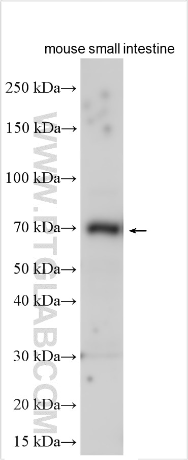 Western Blot (WB) analysis of various lysates using Trehalase Polyclonal antibody (21685-1-AP)
