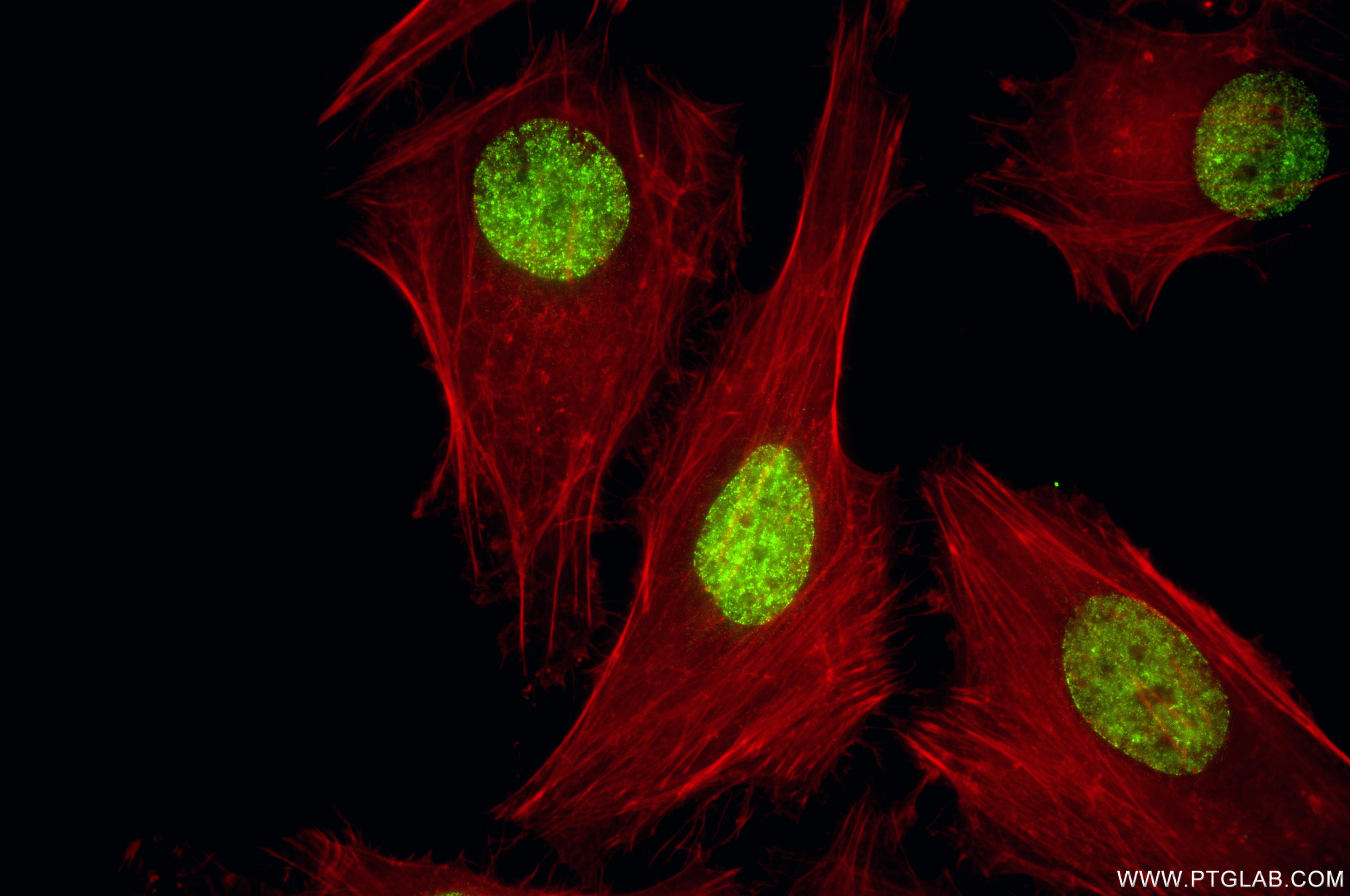 Immunofluorescence (IF) / fluorescent staining of HeLa cells using Tri-Methyl-Histone H3 (Lys27) Recombinant monoclon (86992-1-RR)