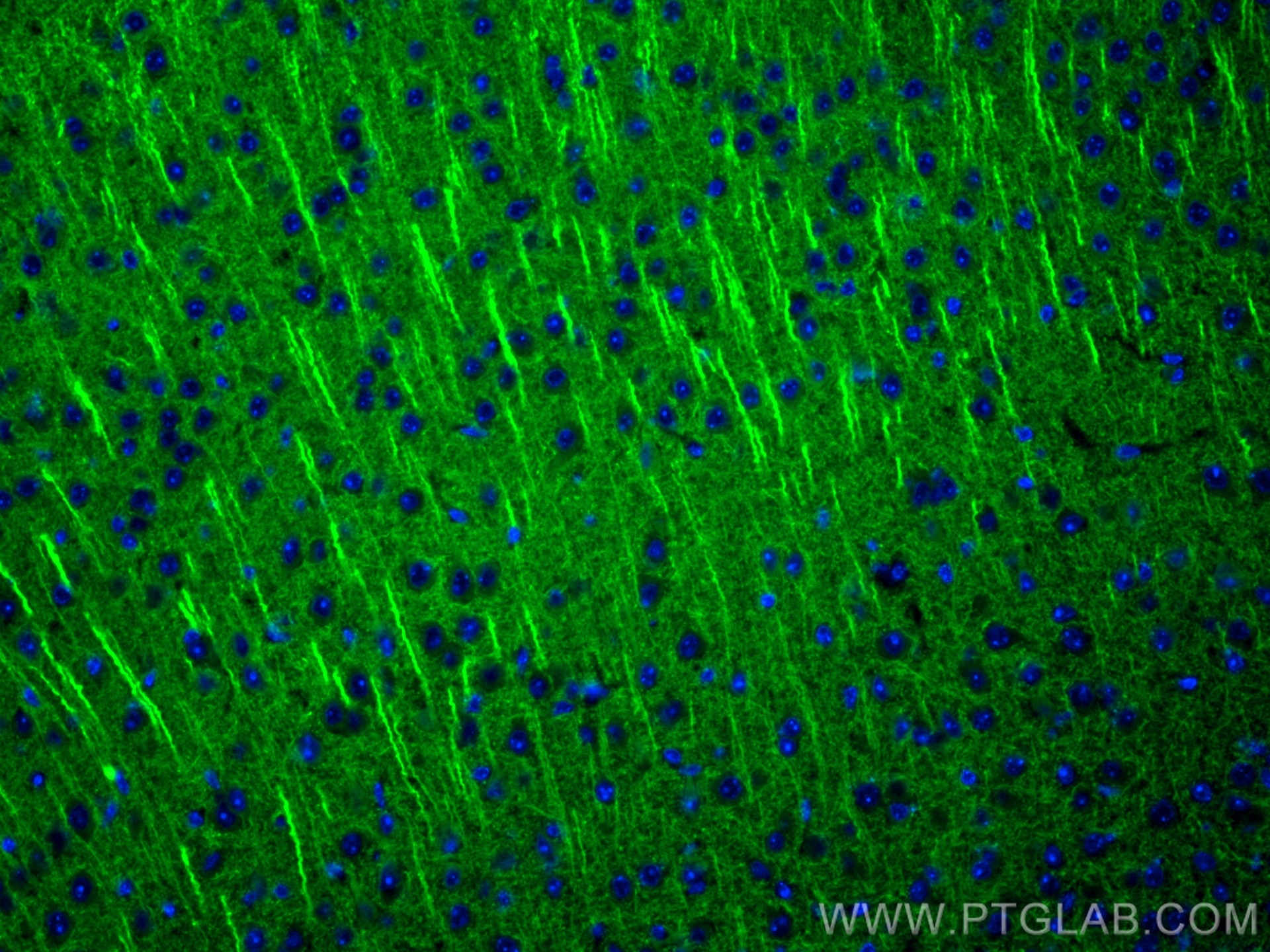 Immunofluorescence (IF) / fluorescent staining of mouse brain tissue using TrkB Polyclonal antibody (29961-1-AP)