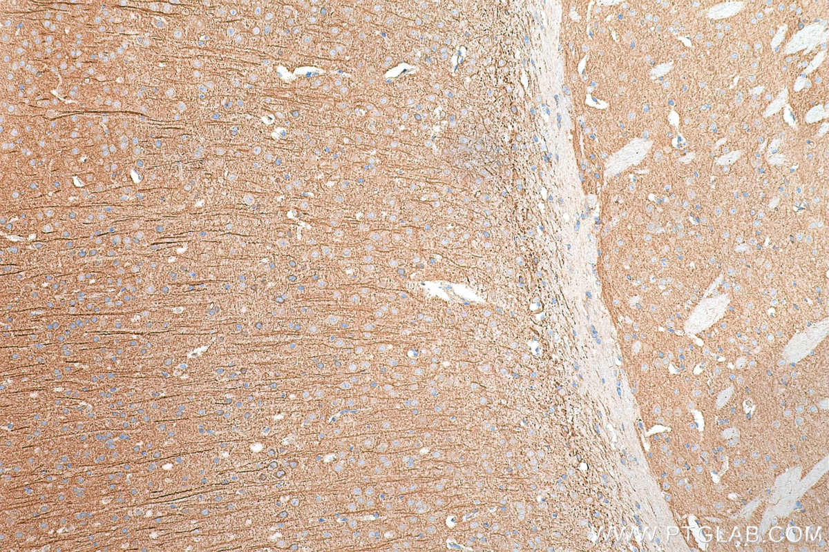 IHC staining of mouse brain using 29961-1-AP
