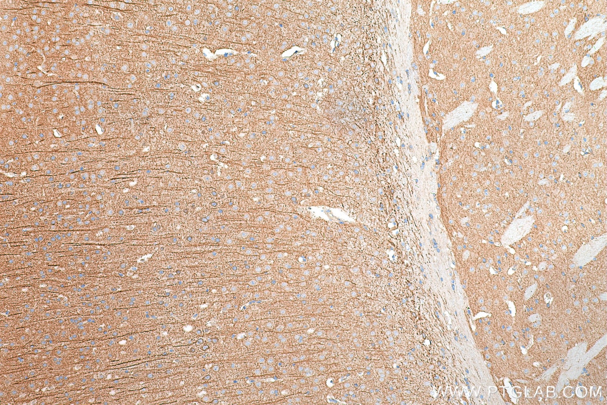 Immunohistochemistry (IHC) staining of mouse brain tissue using TrkB Polyclonal antibody (29961-1-AP)