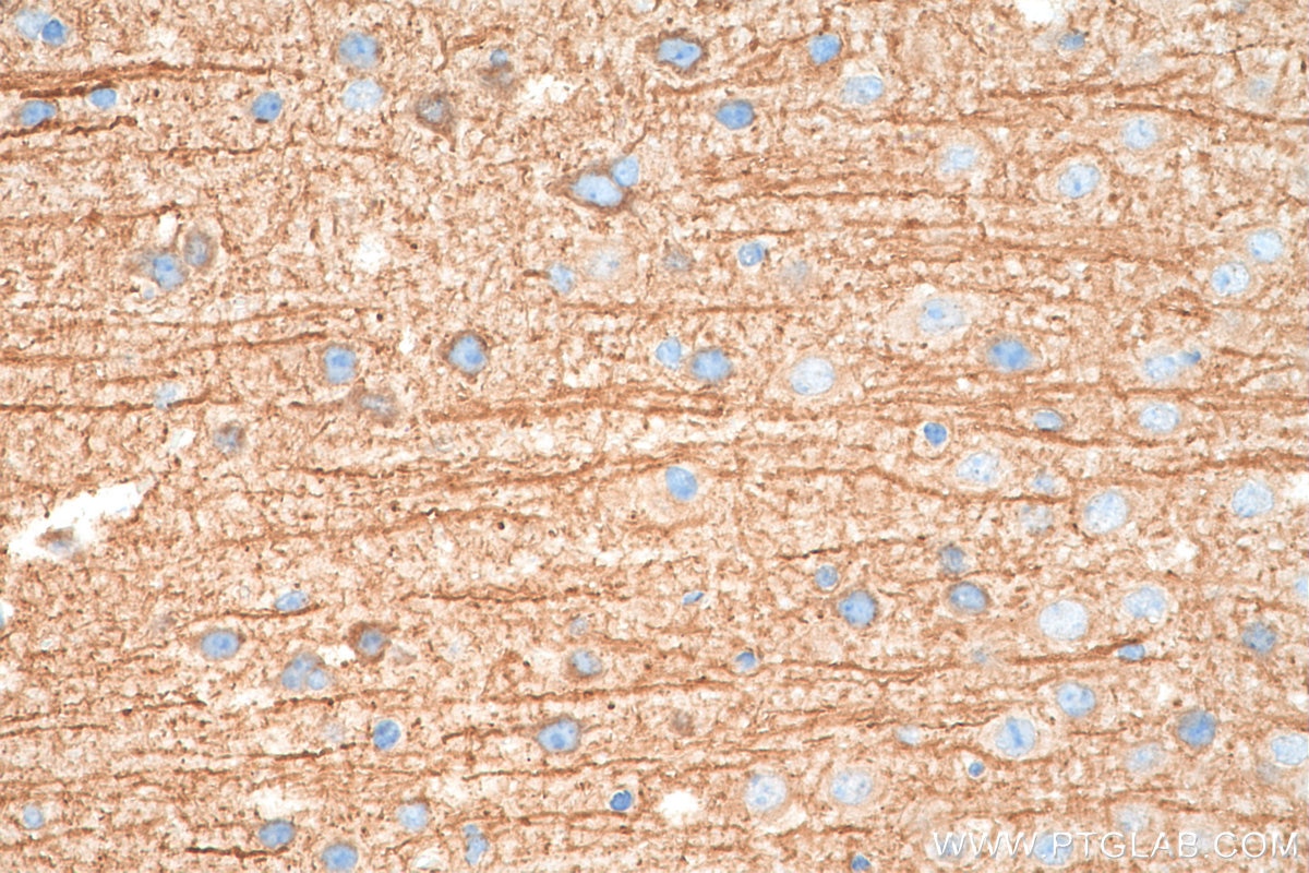 Immunohistochemistry (IHC) staining of mouse brain tissue using TrkB Polyclonal antibody (29961-1-AP)