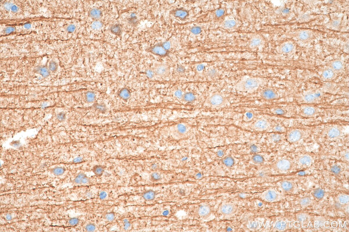 Immunohistochemistry (IHC) staining of mouse brain tissue using TrkB Polyclonal antibody (29961-1-AP)