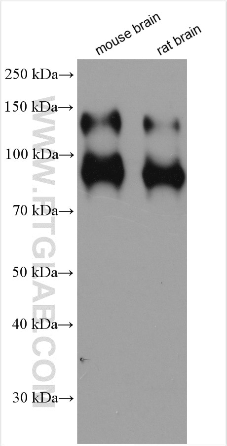 Western Blot (WB) analysis of various lysates using TrkB Polyclonal antibody (29961-1-AP)