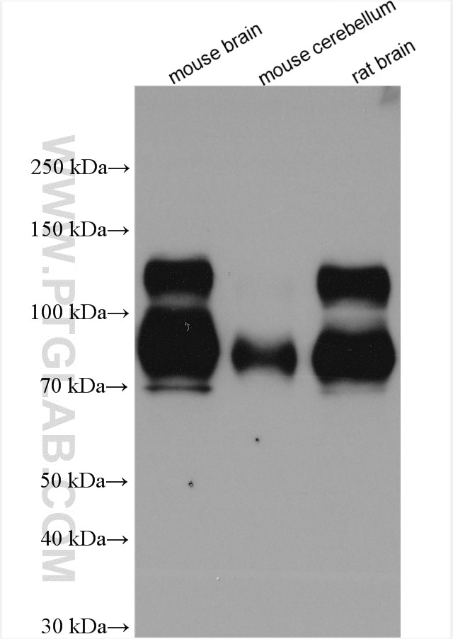 Western Blot (WB) analysis of various lysates using TrkB Polyclonal antibody (29961-1-AP)