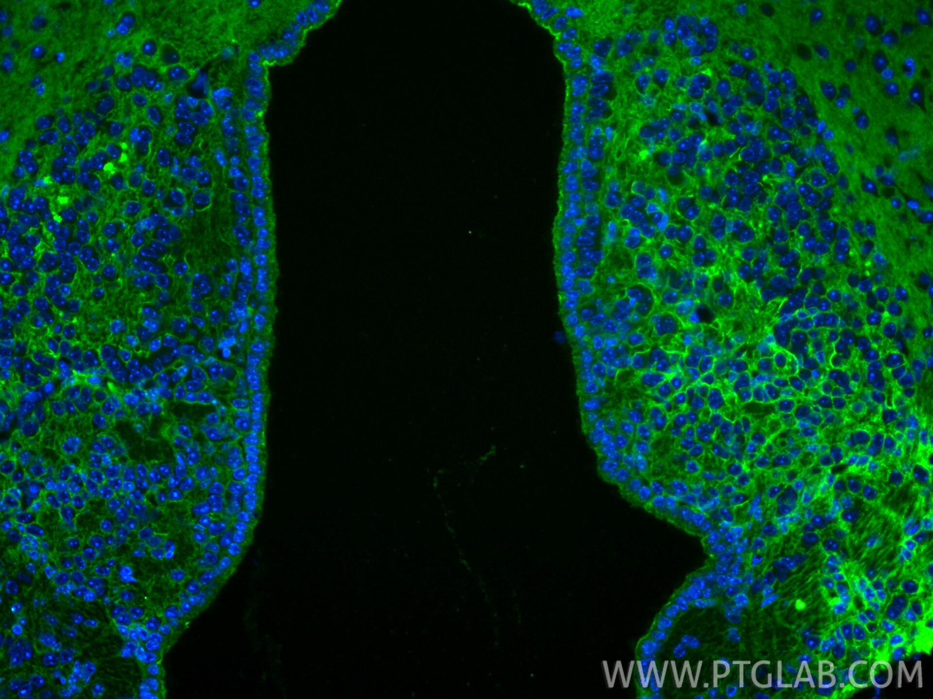 Immunofluorescence (IF) / fluorescent staining of mouse brain tissue using TrkB Polyclonal antibody (33093-1-AP)