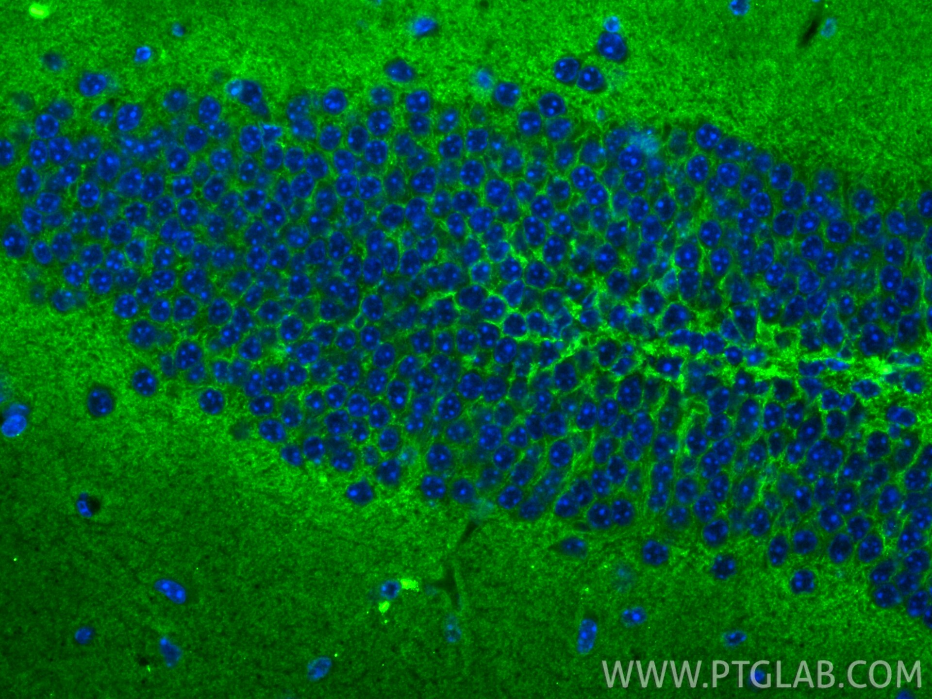 Immunofluorescence (IF) / fluorescent staining of mouse brain tissue using TrkB Polyclonal antibody (33093-1-AP)