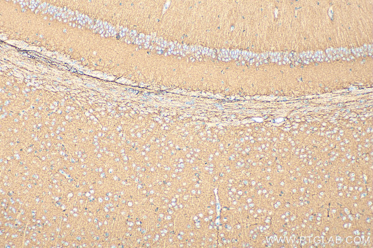 Immunohistochemistry (IHC) staining of mouse brain tissue using TrkB Polyclonal antibody (33093-1-AP)
