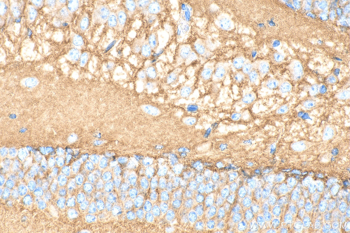 Immunohistochemistry (IHC) staining of mouse brain tissue using TrkB Polyclonal antibody (33093-1-AP)