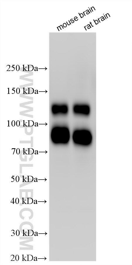 Western Blot (WB) analysis of various lysates using TrkB Polyclonal antibody (33093-1-AP)