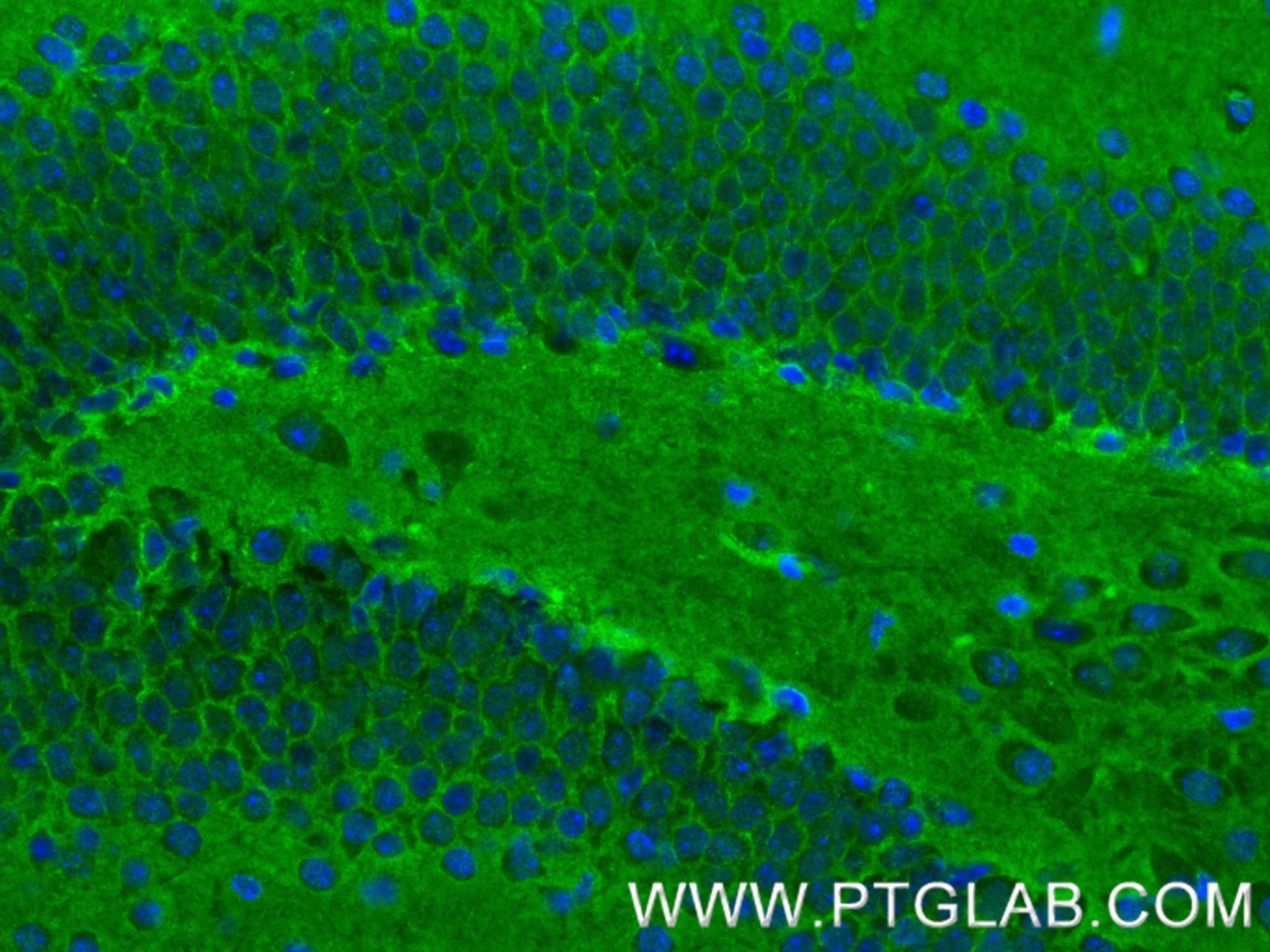 Immunofluorescence (IF) / fluorescent staining of mouse brain tissue using TrkB Recombinant antibody (80878-6-RR)