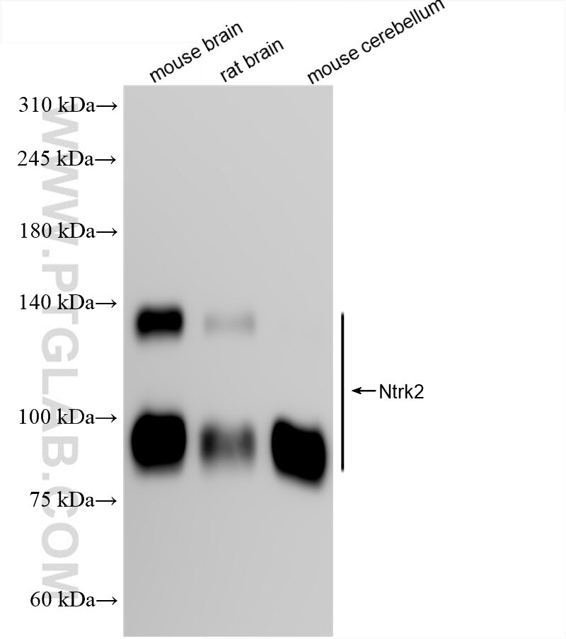 Western Blot (WB) analysis of mouse brain tissue using TrkB Recombinant antibody (85971-3-RR)