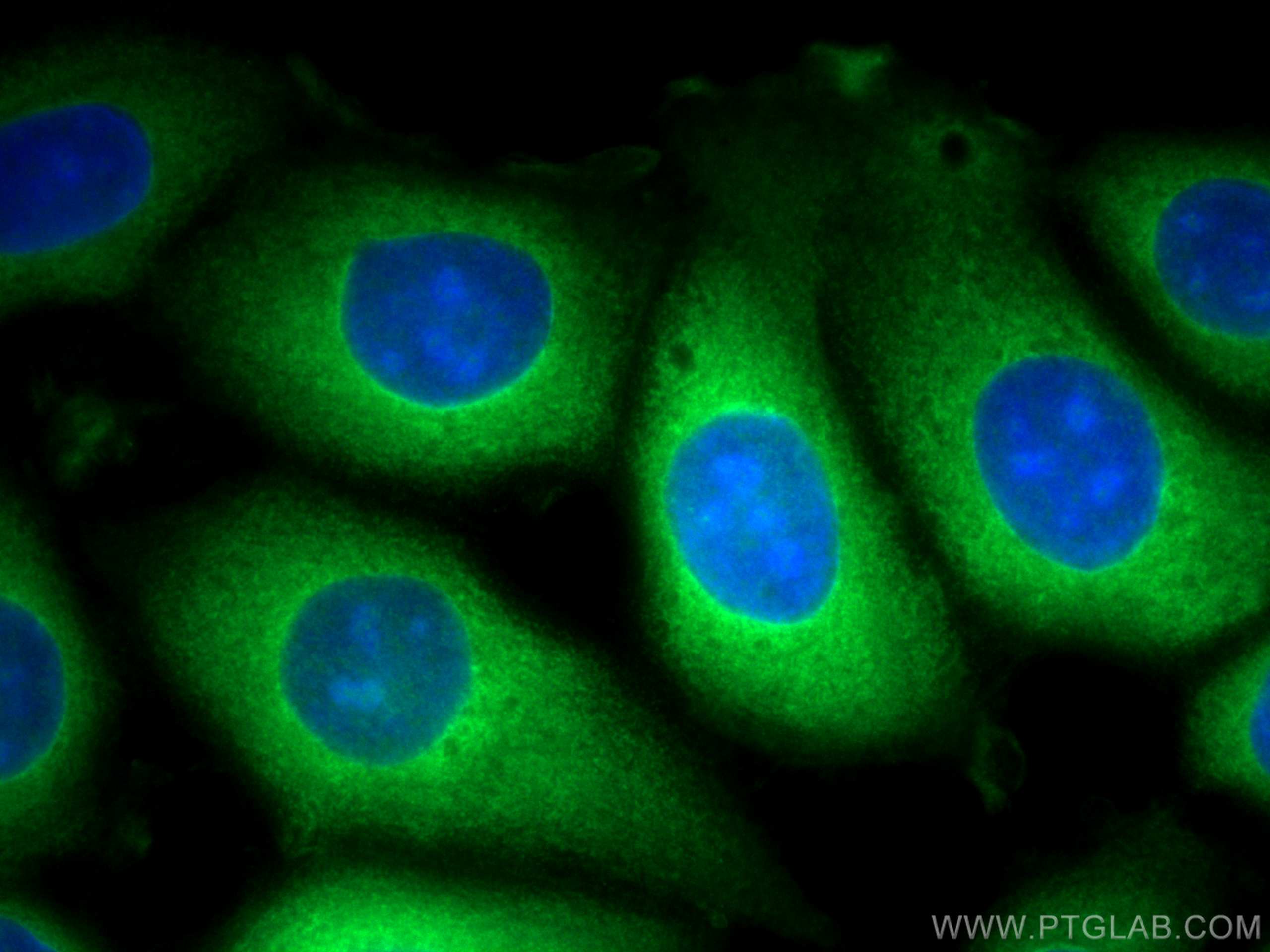 Immunofluorescence (IF) / fluorescent staining of MCF-7 cells using CoraLite® Plus 488-conjugated TrpRS Monoclonal ant (CL488-67952)