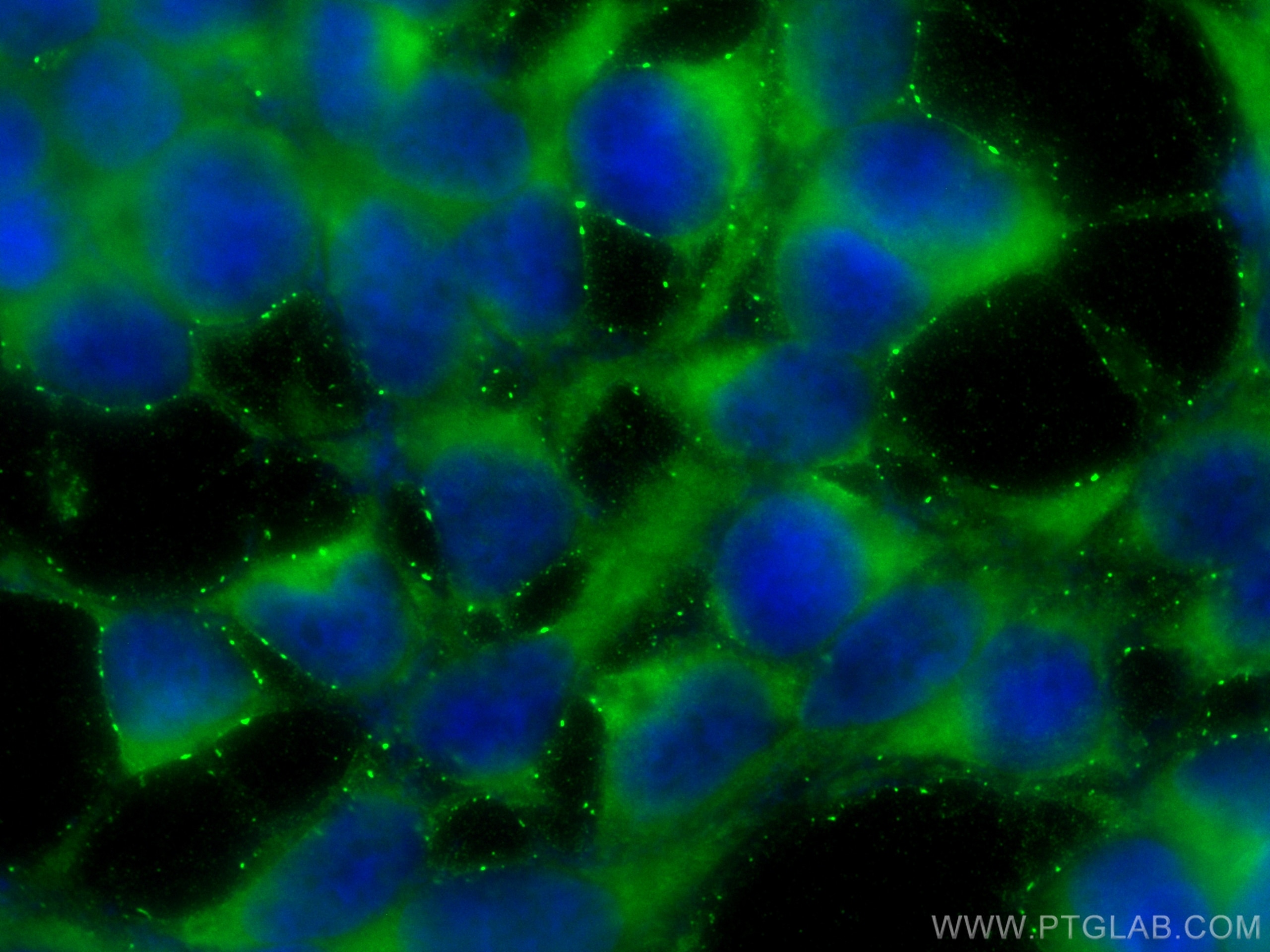 Immunofluorescence (IF) / fluorescent staining of HEK-293 cells using CoraLite® Plus 488-conjugated Tuberin/TSC2 Polyclo (CL488-24601)