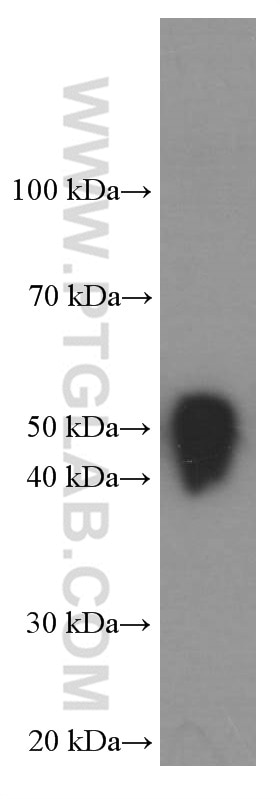 Alpha Tubulin