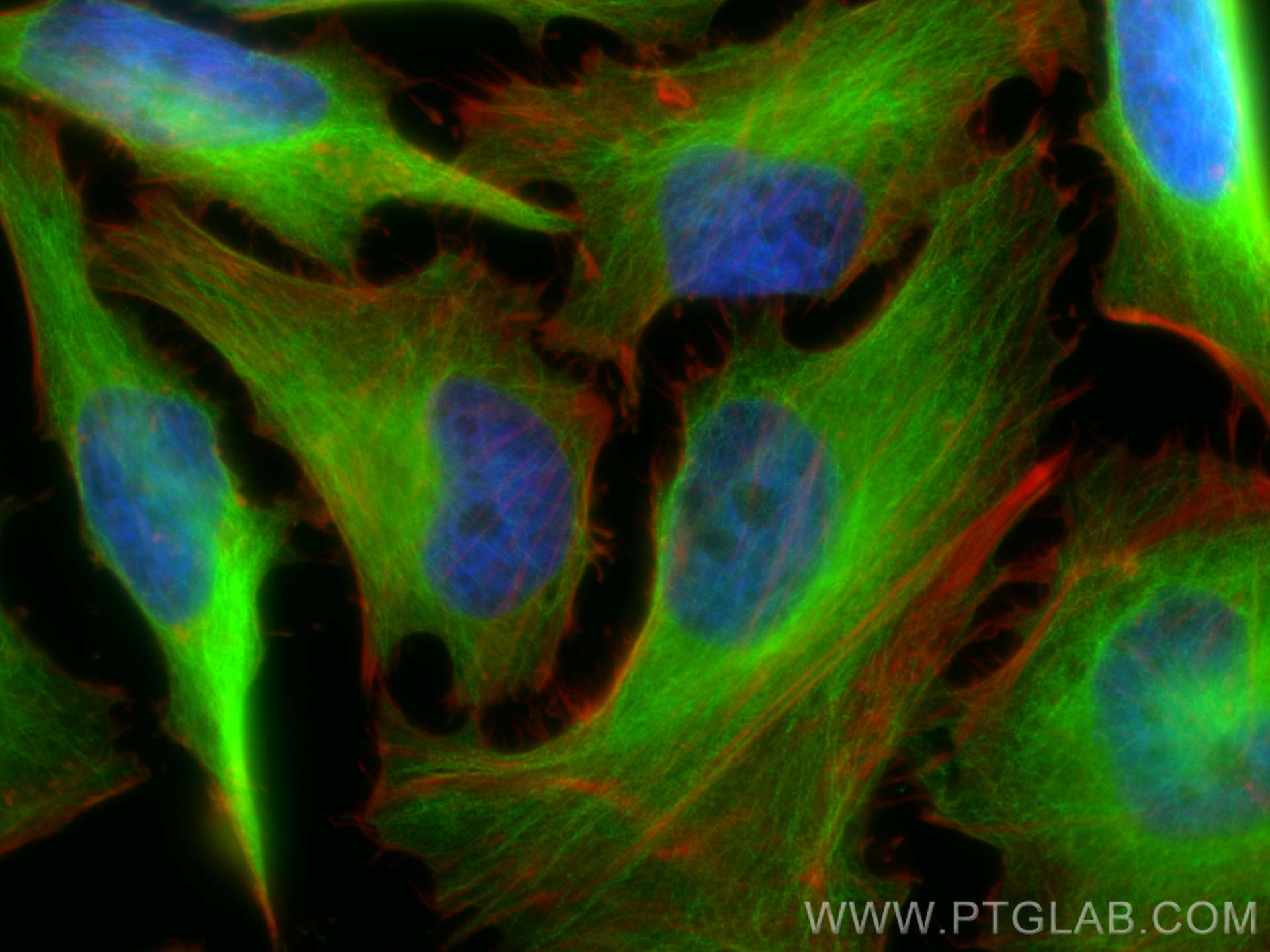 Immunofluorescence (IF) / fluorescent staining of HeLa cells using Beta Tubulin Monoclonal antibody (66240-1-Ig)