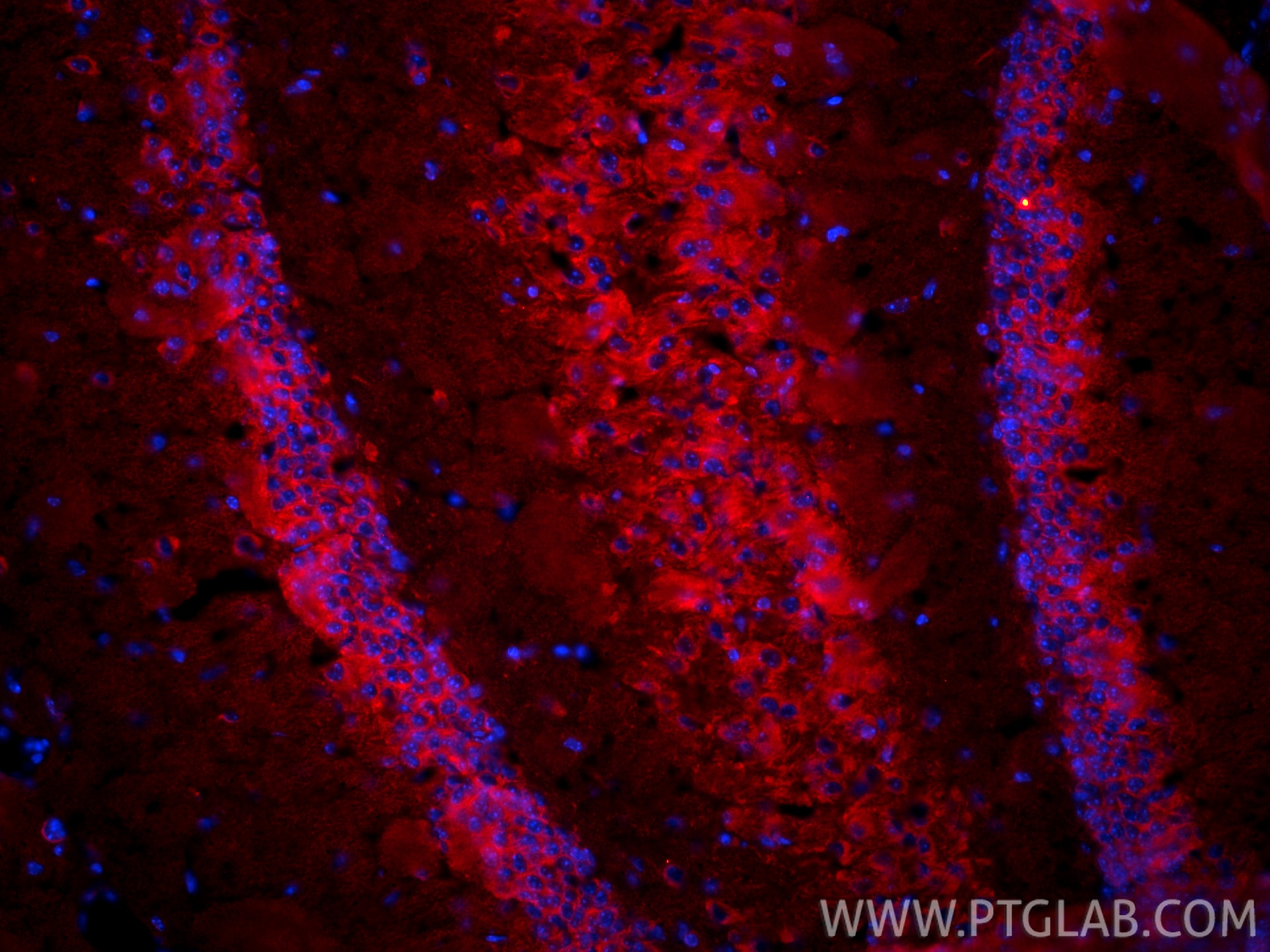 Immunofluorescence (IF) / fluorescent staining of mouse brain tissue using Beta Tubulin Monoclonal antibody (66240-1-Ig)