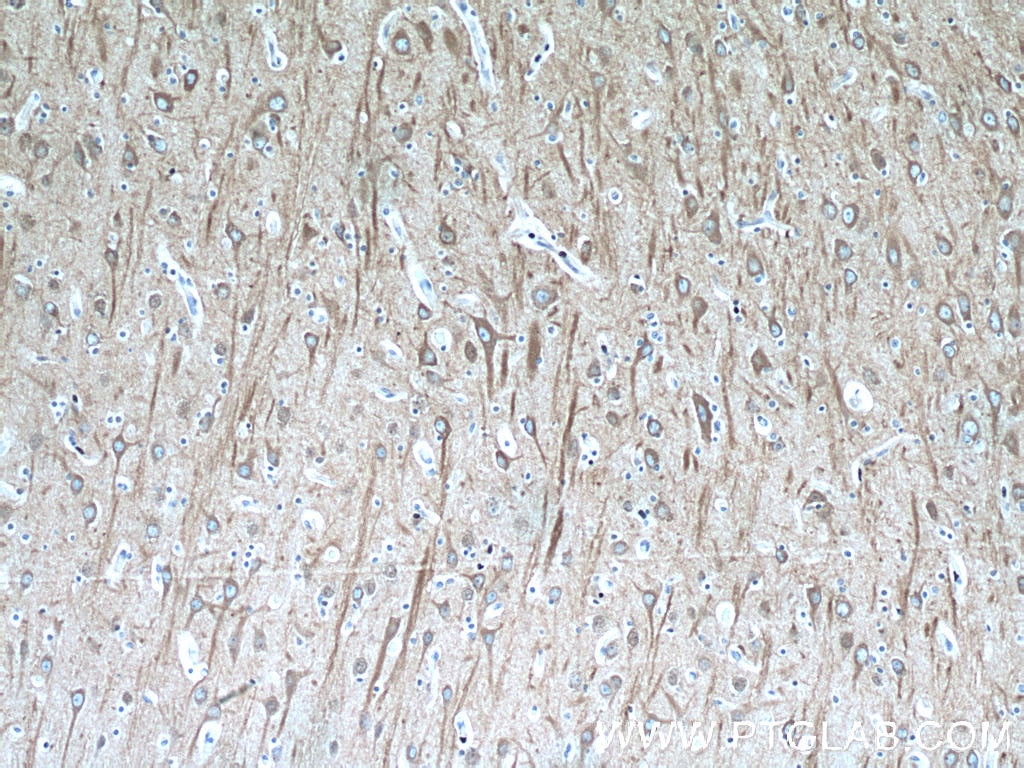 Immunohistochemistry (IHC) staining of human brain tissue using Beta Tubulin Monoclonal antibody (66240-1-Ig)