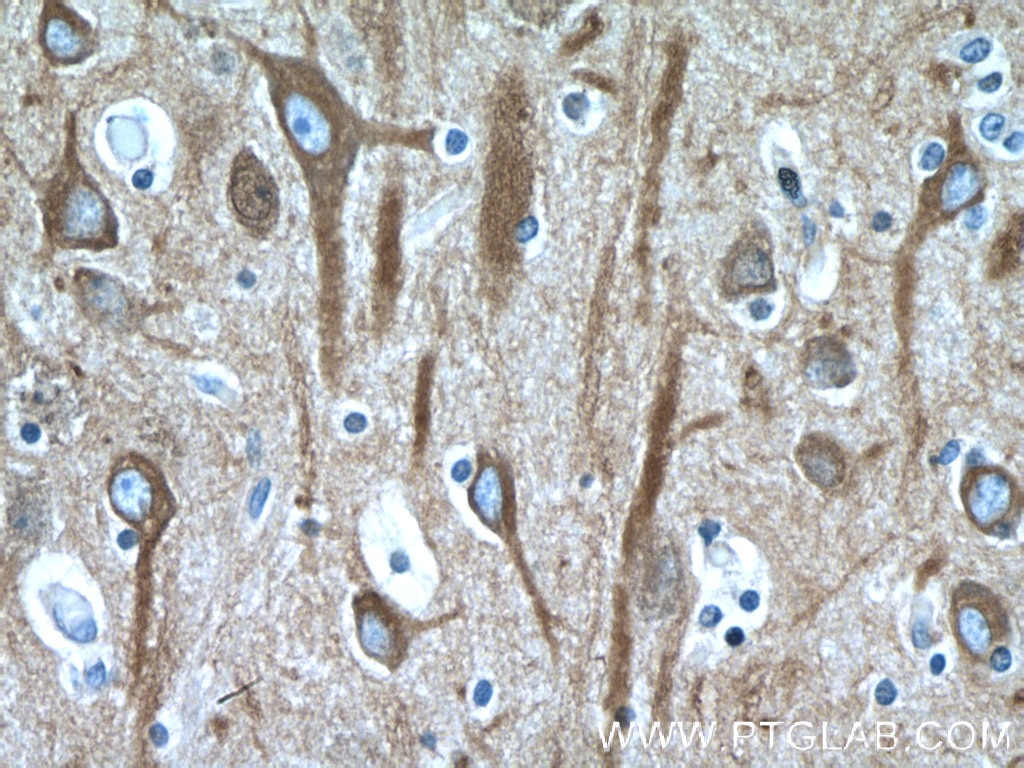 Immunohistochemistry (IHC) staining of human brain tissue using Beta Tubulin Monoclonal antibody (66240-1-Ig)