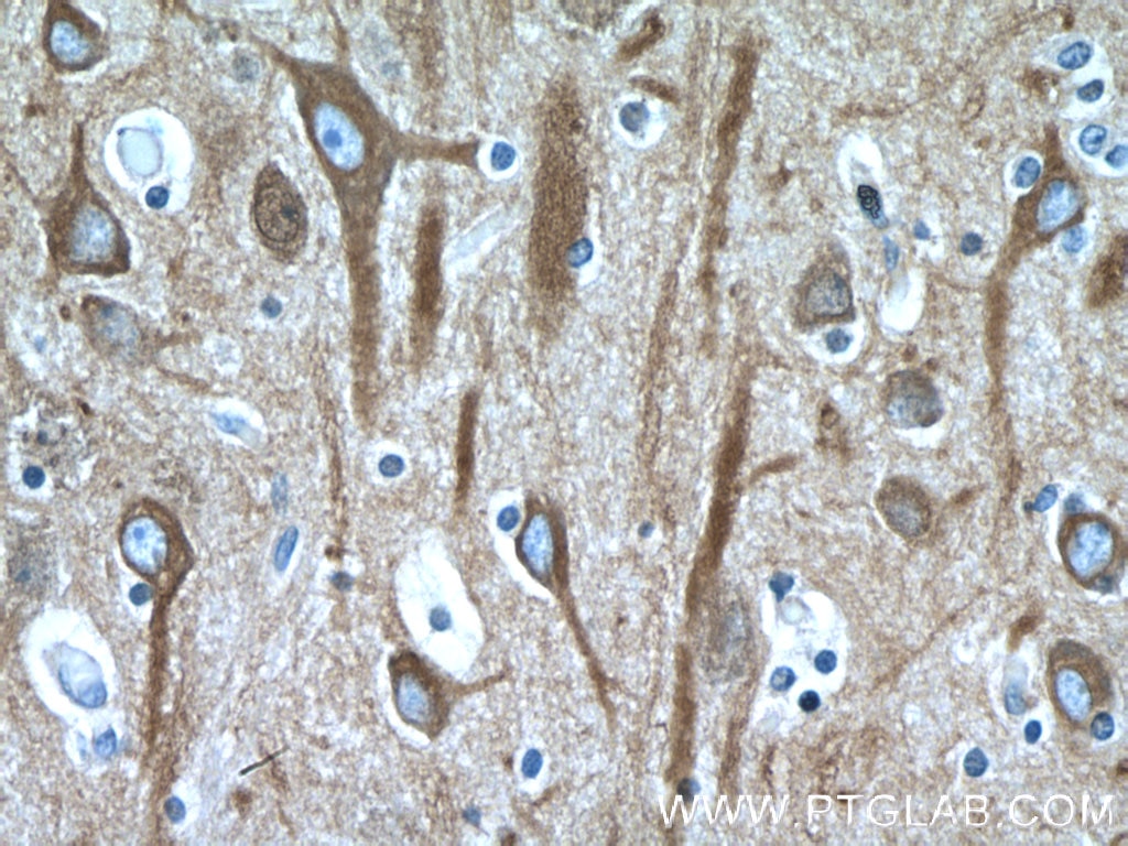 Beta Tubulin Monoclonal antibody