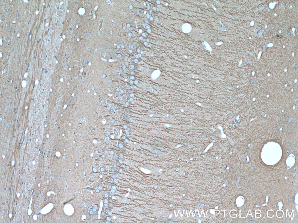 Immunohistochemistry (IHC) staining of rat brain tissue using Beta Tubulin Monoclonal antibody (66240-1-Ig)