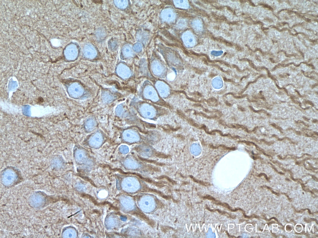 Immunohistochemistry (IHC) staining of rat brain tissue using Beta Tubulin Monoclonal antibody (66240-1-Ig)