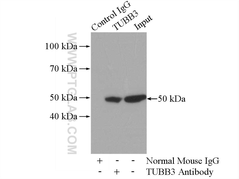 Immunoprecipitation (IP) experiment of HeLa cells using Beta Tubulin Monoclonal antibody (66240-1-Ig)