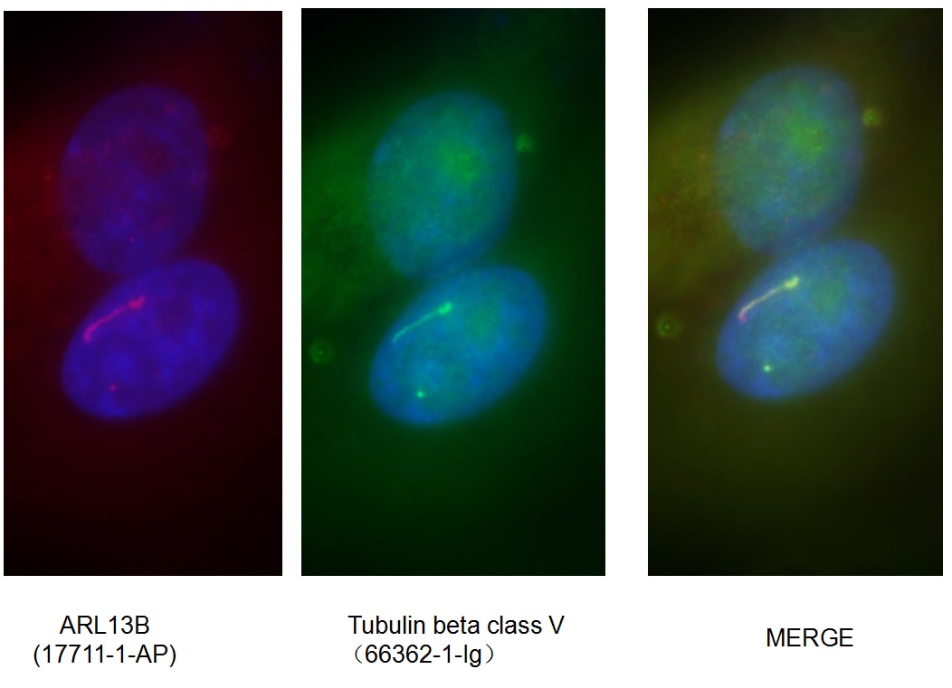 IF analysis of ( 4% PFA ) fixed MDCK cells using 66362-1-Ig(Tubulin beta class V antibody) at dilution of 1:100 and Alexa Fluor 488-conjugated AffiniPure Goat Anti-Mouse IgG(H+L)