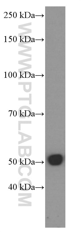 Western Blot (WB) analysis of NCCIT cells using Tubulin Beta Class V Monoclonal antibody (66362-1-Ig)