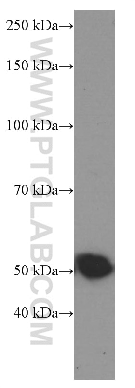 Western Blot (WB) analysis of HeLa cells using Tubulin Beta Class V Monoclonal antibody (66362-1-Ig)