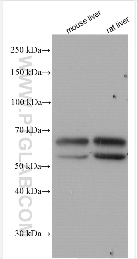 Western Blot (WB) analysis of various lysates using Tyrosinase Polyclonal antibody (21995-1-AP)